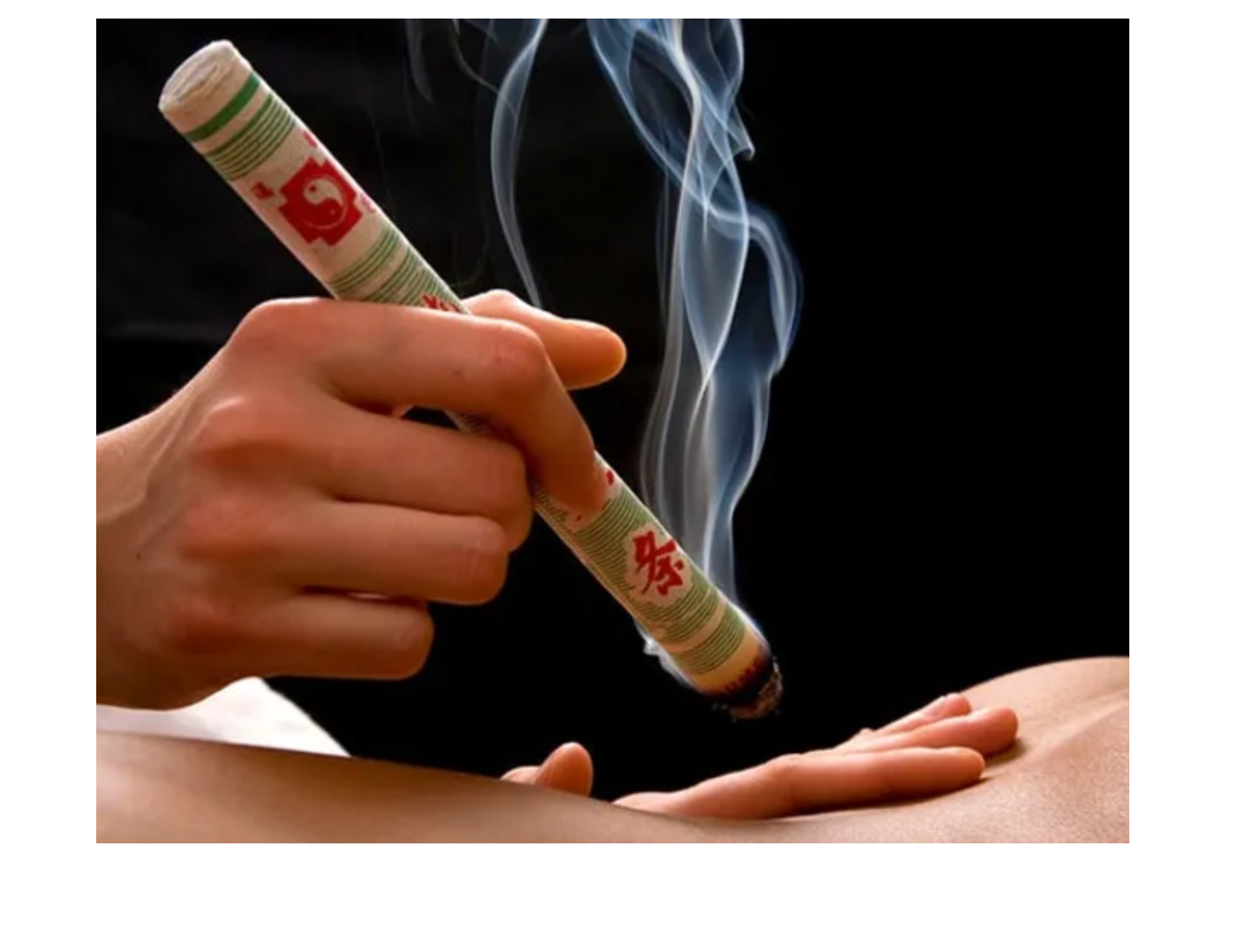 Moxibustion et médecine chinoise à Montpelier-Sylvie Friedlander