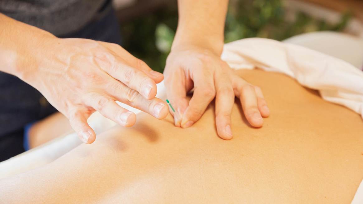 Acupuncture-Montpellier- Digitopuncture-Sylvie Friedlander